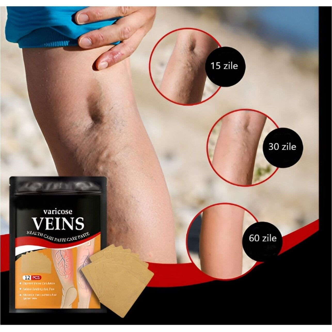 Set 24 Plasturi pentru Varice, Reduc Disconfortul si Oboseala Picioarelor - PromotiiZilnice